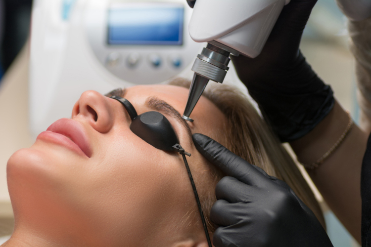 brow750 Laser eyebrow removal waterlooville