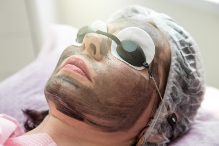 carbon750 carbon facials Waterlooville