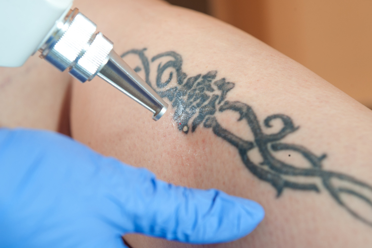 tattoo1 Tattoo Waterlooville